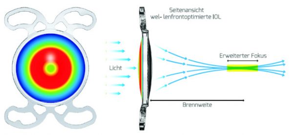 164-MINI-WELL-TORIC-Ready